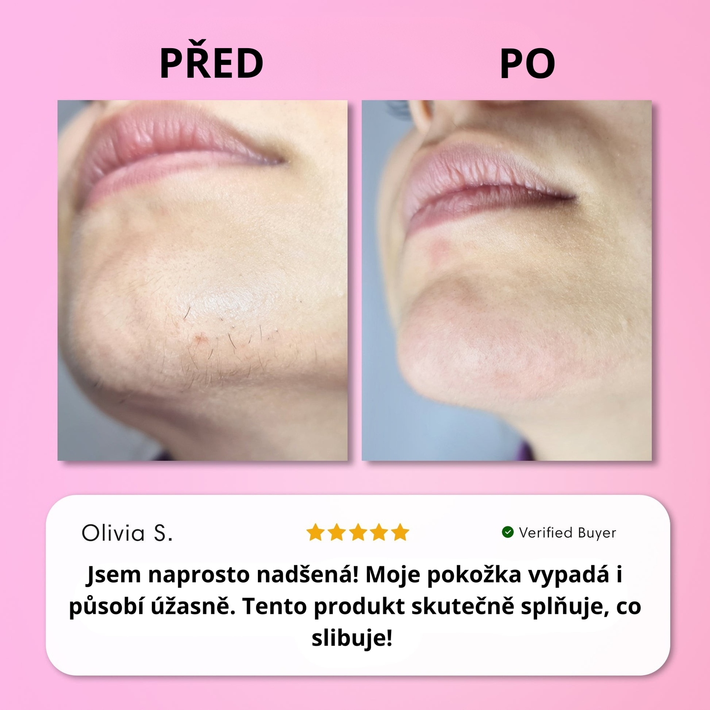 Sada na okamžité odstranění chloupků