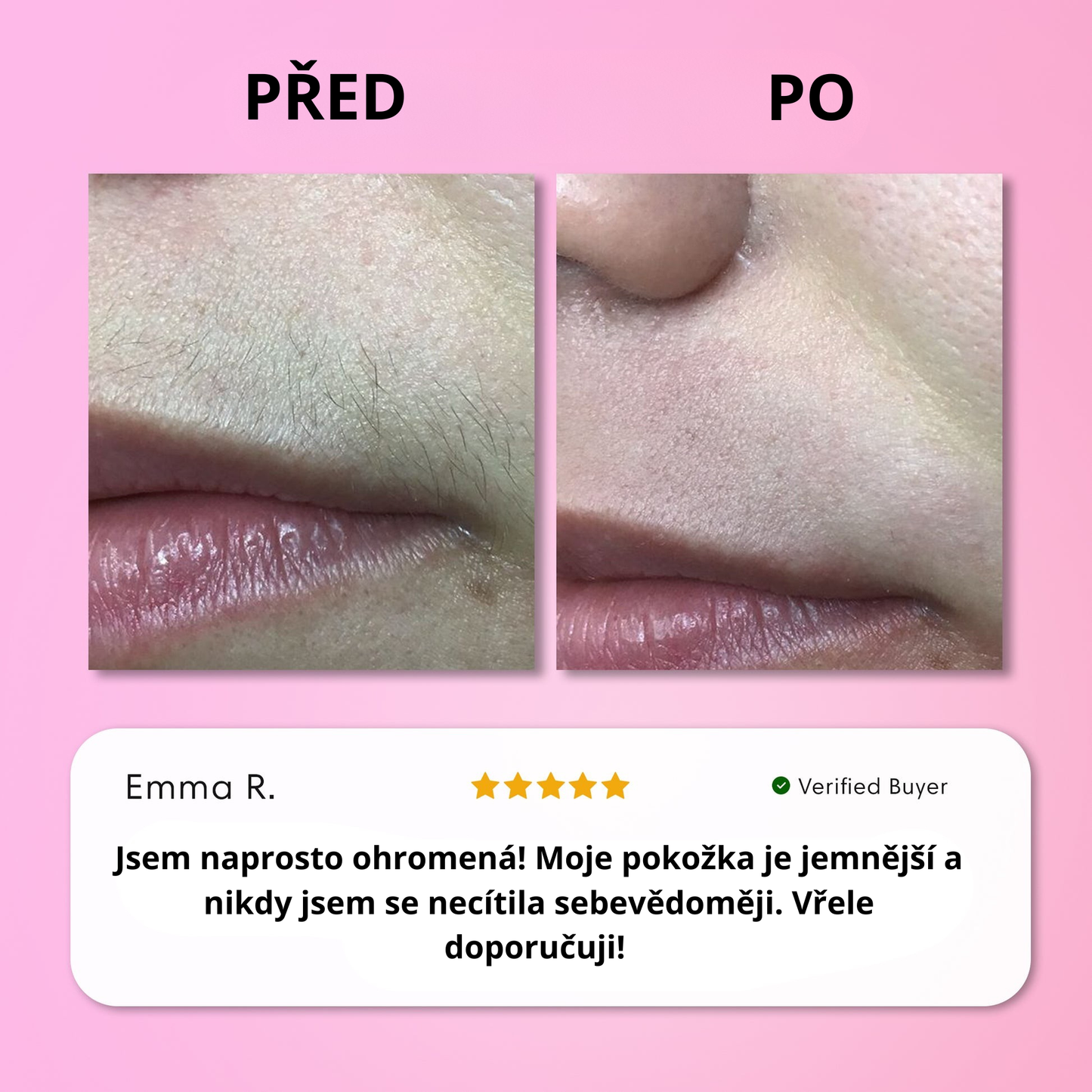 Sada na okamžité odstranění chloupků