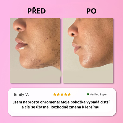 Sada na okamžité odstranění chloupků