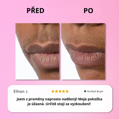 Sada na okamžité odstranění chloupků