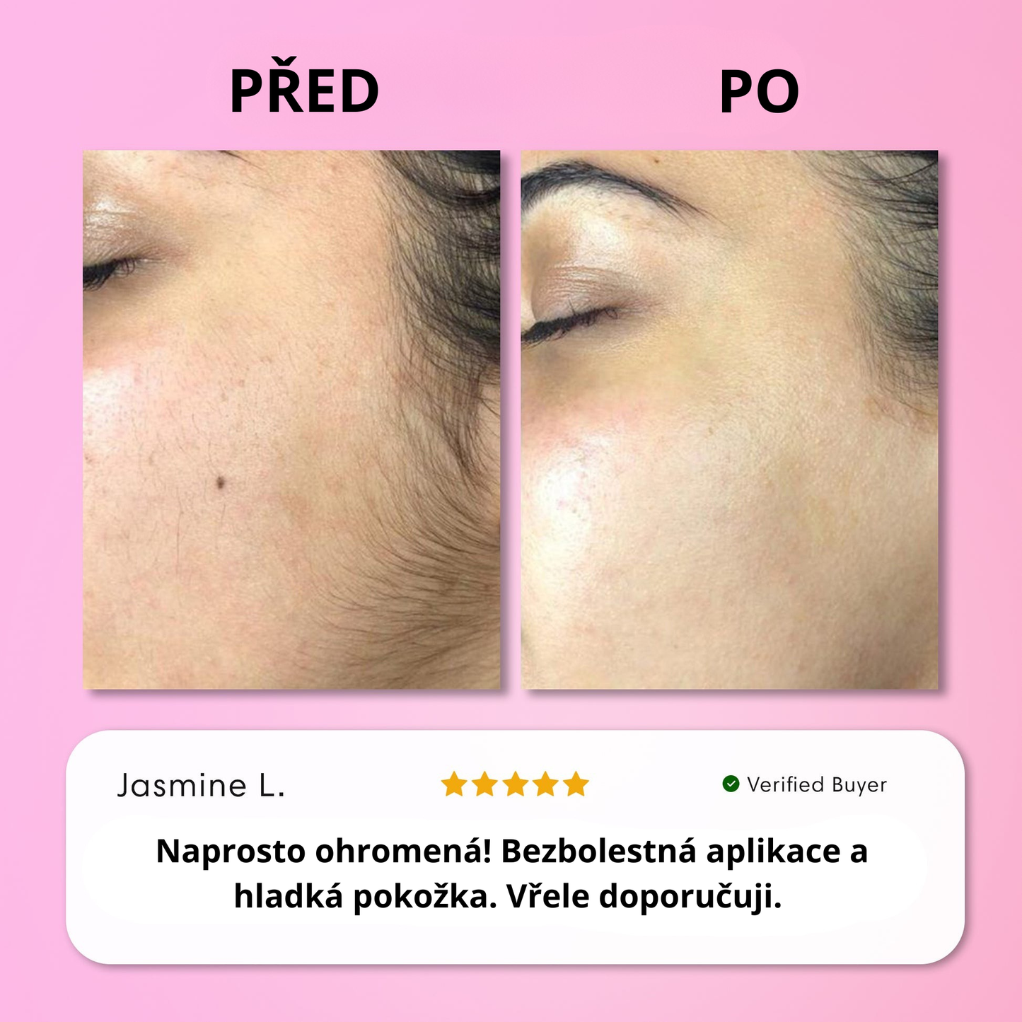 Sada na okamžité odstranění chloupků