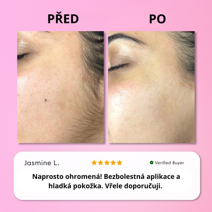 Sada na okamžité odstranění chloupků