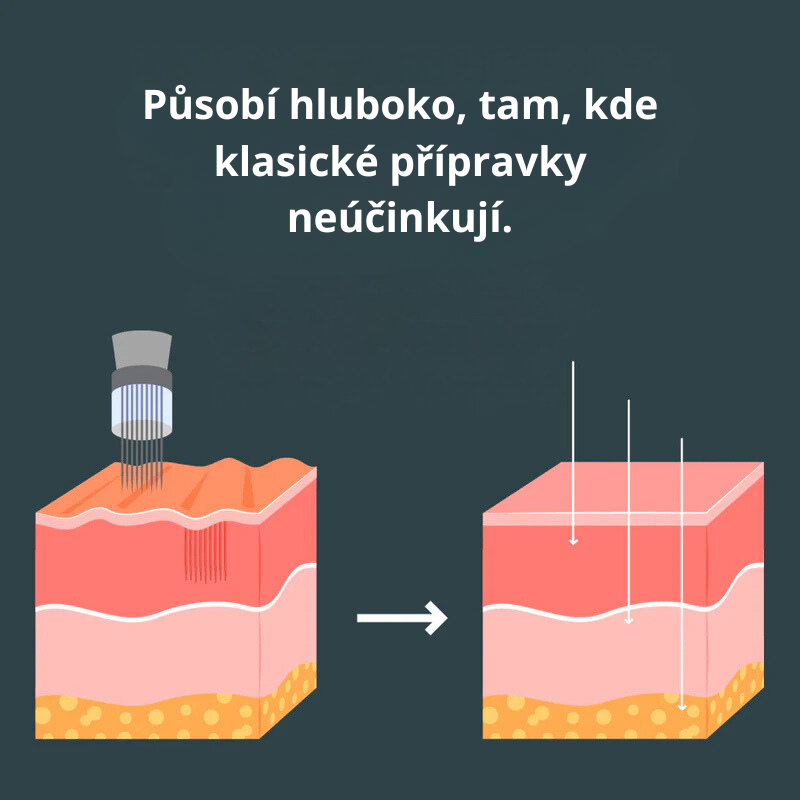 Ceralyne – Microinfuzní Lift Pro + sérum ZDARMA