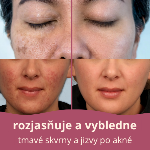 rozjasňující tampony s kurkumou a kyselinou kojovou