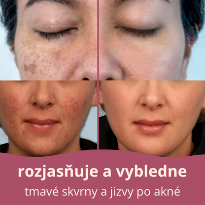 rozjasňující tampony s kurkumou a kyselinou kojovou