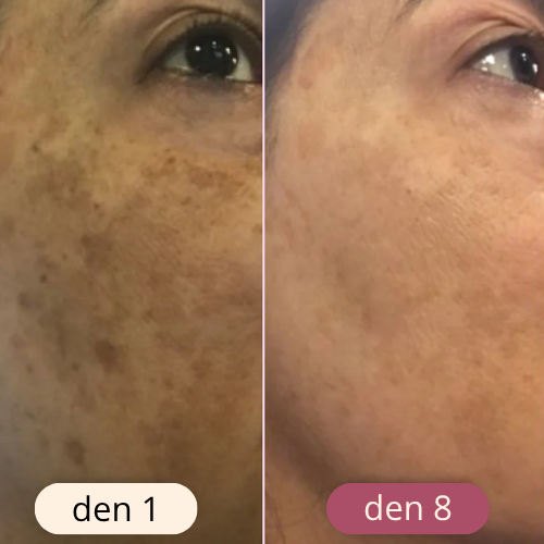 rozjasňující tampony s kurkumou a kyselinou kojovou