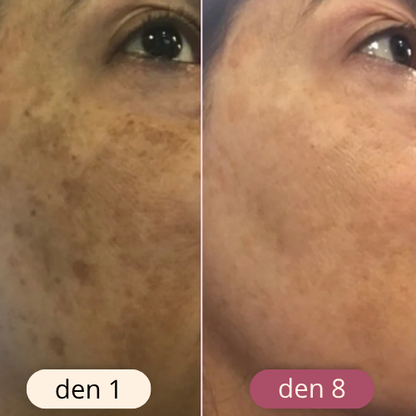 rozjasňující tampony s kurkumou a kyselinou kojovou