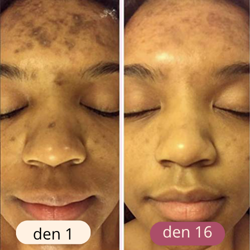 rozjasňující tampony s kurkumou a kyselinou kojovou