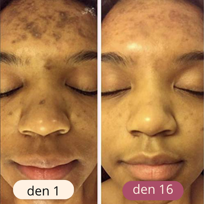 rozjasňující tampony s kurkumou a kyselinou kojovou