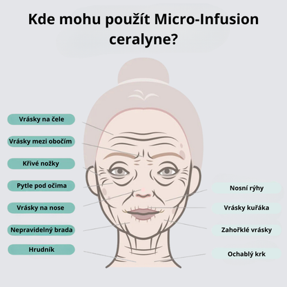 Ceralyne – Microinfuzní Lift Pro + sérum ZDARMA